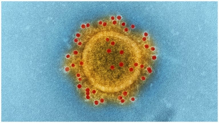 COVID-19 XBB.1.5 Variant: What You Should Know